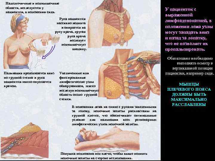 Надключичные и подмышечные области, исследуются у пациентки, в положении сидя. Рука пациентки пассивно поднята