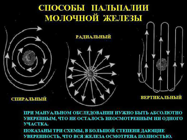 СПОСОБЫ ПАЛЬПАЛИИ МОЛОЧНОЙ ЖЕЛЕЗЫ РАДИАЛЬНЫЙ СПИРАЛЬНЫЙ ВЕРТИКАЛЬНЫЙ ПРИ МАНУАЛЬНОМ ОБСЛЕДОВАНИИ НУЖНО БЫТЬ АБСОЛЮТНО УВЕРЕННЫМ,