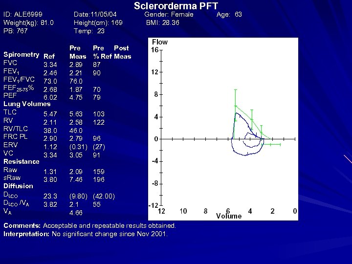 ID: ALE 6999 Weight(kg): 81. 0 PB: 767 Spirometry Ref FVC 3. 34 FEV