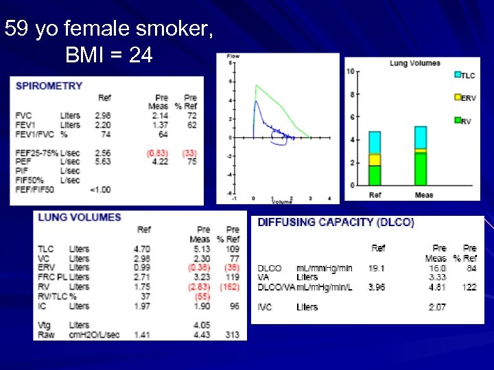 59 yo female smoker, BMI = 24 