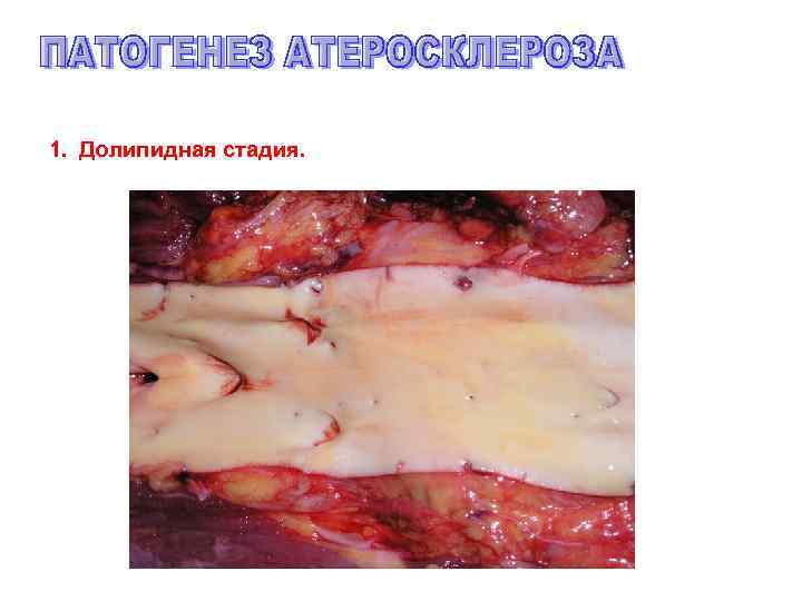 1. Долипидная стадия. 