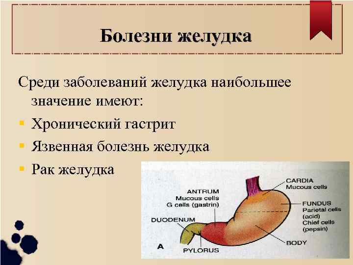 Болезни желудка Среди заболеваний желудка наибольшее значение имеют: Хронический гастрит Язвенная болезнь желудка Рак