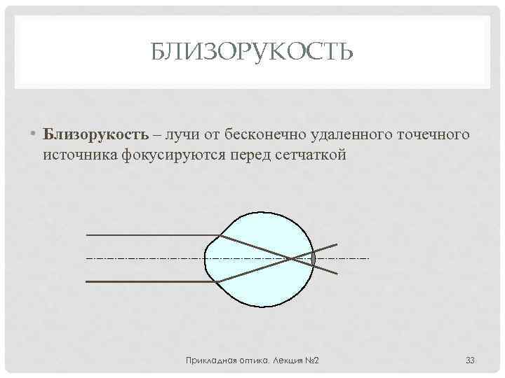 БЛИЗОРУКОСТЬ • Близорукость – лучи от бесконечно удаленного точечного источника фокусируются перед сетчаткой Прикладная