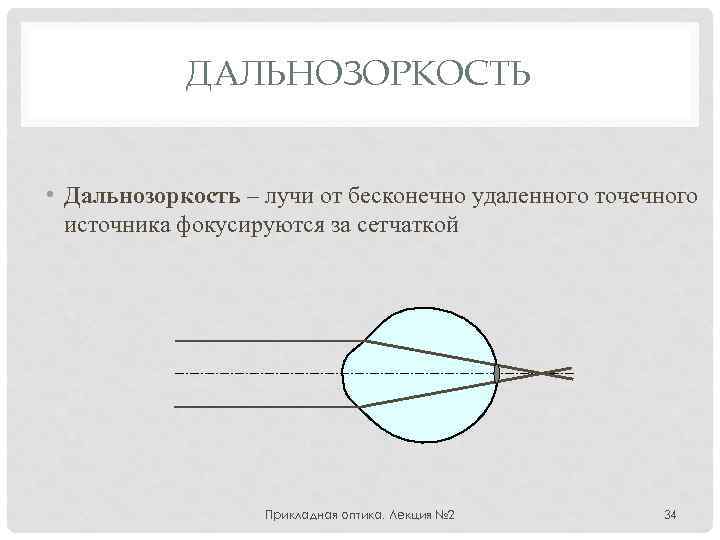 ДАЛЬНОЗОРКОСТЬ • Дальнозоркость – лучи от бесконечно удаленного точечного источника фокусируются за сетчаткой Прикладная