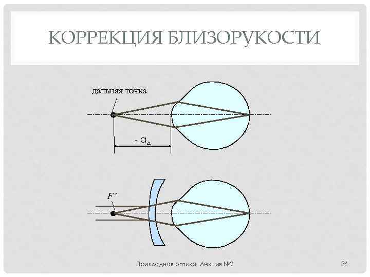 КОРРЕКЦИЯ БЛИЗОРУКОСТИ дальняя точка - aд F Прикладная оптика. Лекция № 2 36 