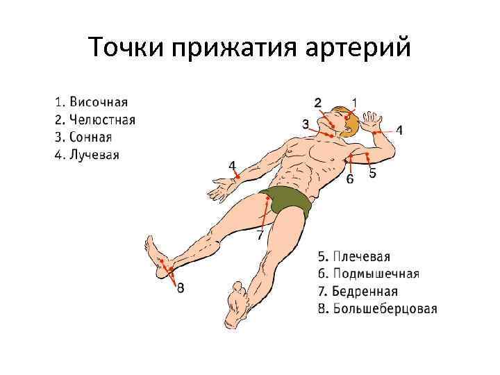 Точки прижатия артерий при кровотечении картинки