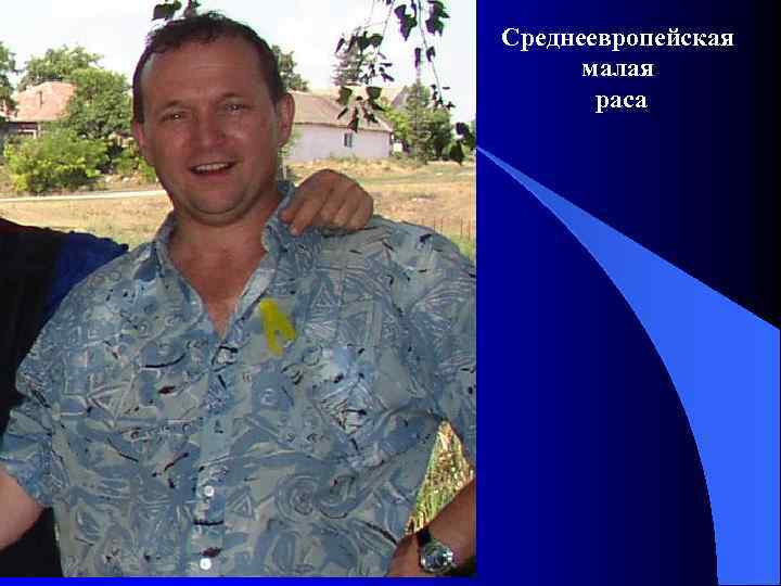 Среднеевропейская малая раса 