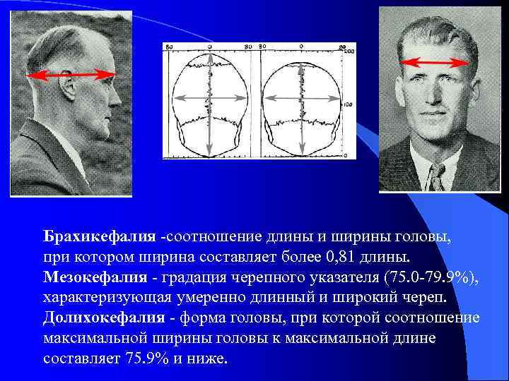 О чем говорят формы черепа