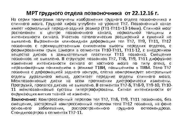 МРТ грудного отдела позвоночника от 22. 16 г. На серии томограмм получены изображения грудного