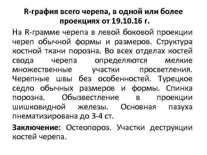 R-графия всего черепа, в одной или более проекциях от 19. 10. 16 г. На