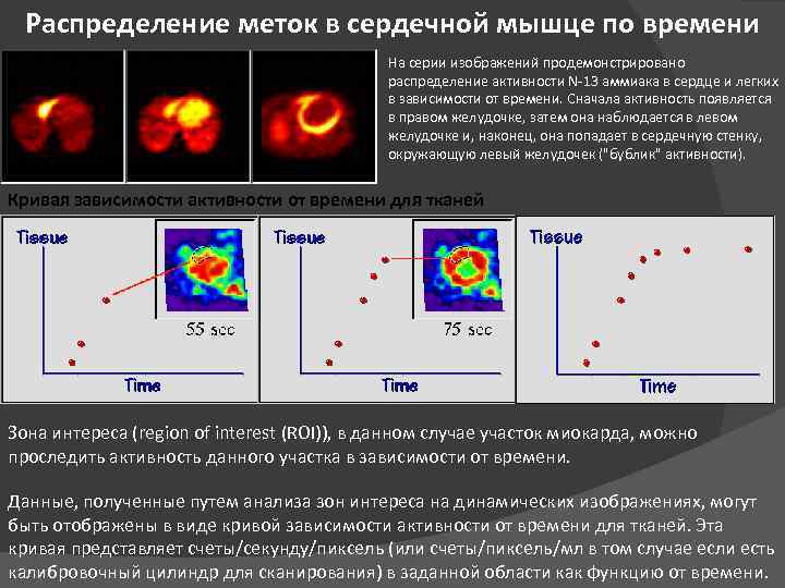Распределение меток в сердечной мышце по времени На серии изображений продемонстрировано распределение активности N-13