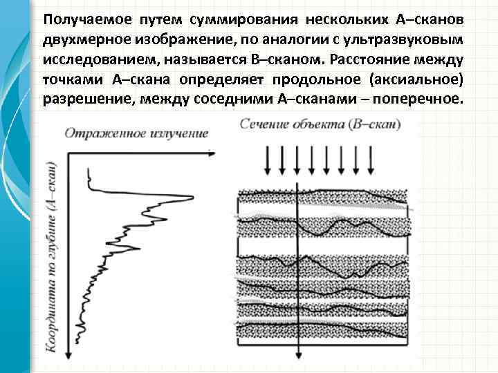 Получаемое путем суммирования нескольких А–сканов двухмерное изображение, по аналогии с ультразвуковым исследованием, называется В–сканом.