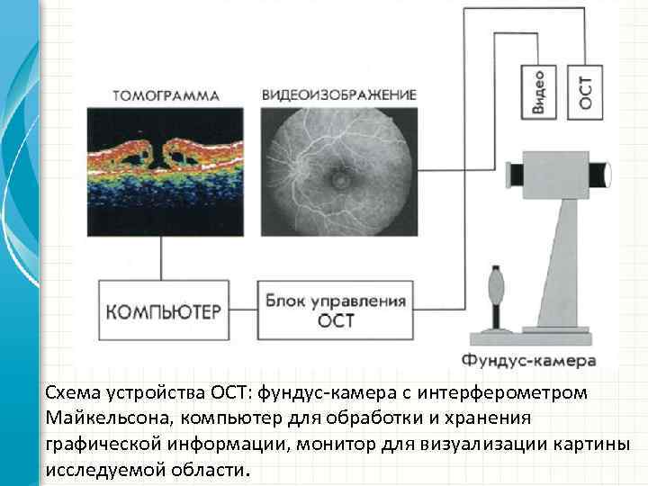 Схема устройства ОСТ: фундус камера с интерферометром Майкельсона, компьютер для обработки и хранения графической