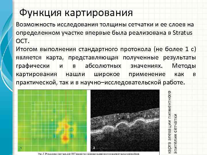 Функция картирования карта элевации пигментного эпителия сетчатки Возможность исследования толщины сетчатки и ее слоев