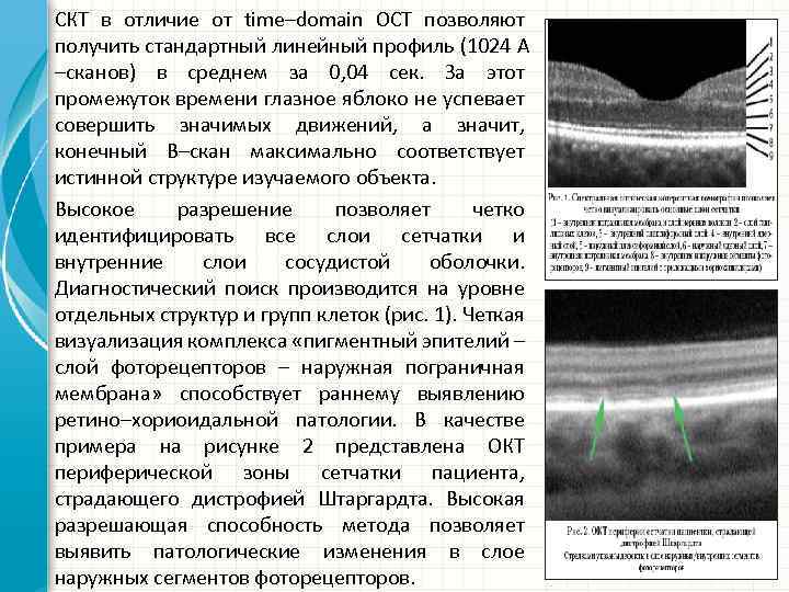 СКТ в отличие от time–domain OCT позволяют получить стандартный линейный профиль (1024 А –сканов)