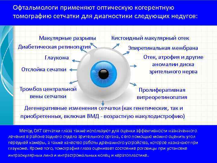 Офтальмологи применяют оптическую когерентную томографию сетчатки для диагностики следующих недугов: Макулярные разрывыледующих Кистоидный макулярный