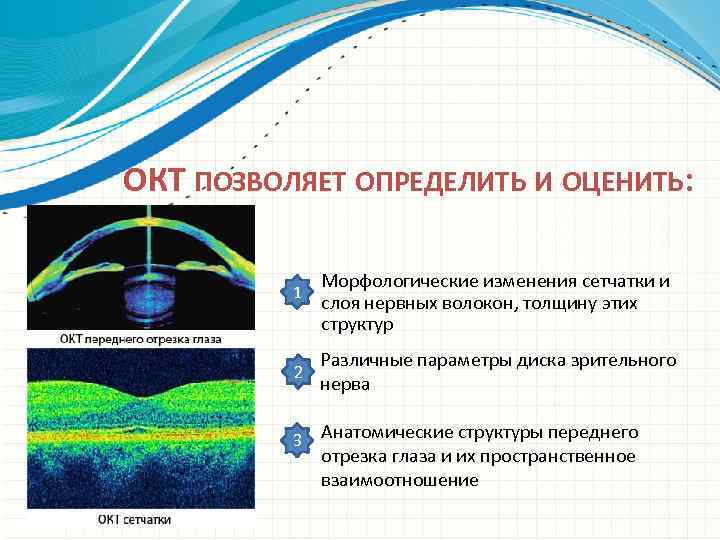 ОКТ ПОЗВОЛЯЕТ ОПРЕДЕЛИТЬ И ОЦЕНИТЬ: 1 2 3 Морфологические изменения сетчатки и слоя нервных