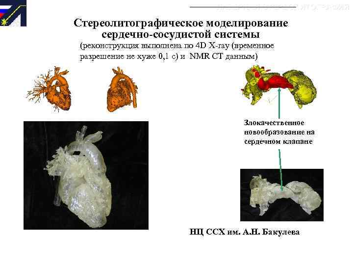 ЛАЗЕРНАЯ СТЕРЕОЛИТОГРАФИЯ Стереолитографическое моделирование сердечно-сосудистой системы (реконструкция выполнена по 4 D X-ray (временное разрешение