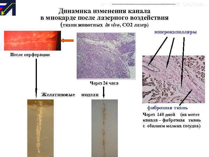 ИНТЕЛЛЕКТУАЛЬНЫЕ ЛАЗЕРНЫЕ СИСТЕМЫ Динамика изменения канала в миокарде после лазерного воздействия (ткани животных in