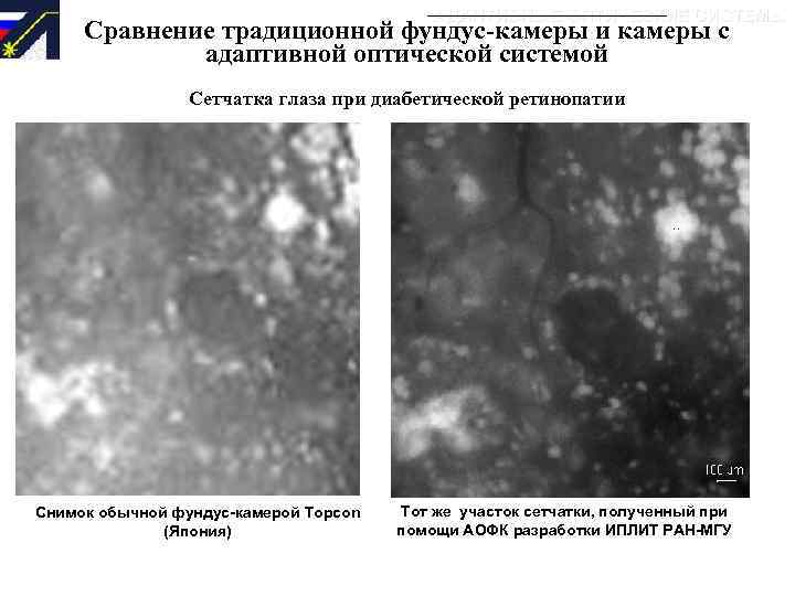 АДАПТИВНЫЕ ОПТИЧЕСКИЕ СИСТЕМЫ Сравнение традиционной фундус-камеры и камеры с адаптивной оптической системой Сетчатка глаза