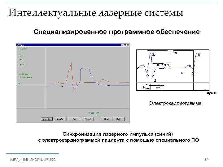 Интеллектуальные лазерные системы Специализированное программное обеспечение 0. 8 s R R 0. 15 s