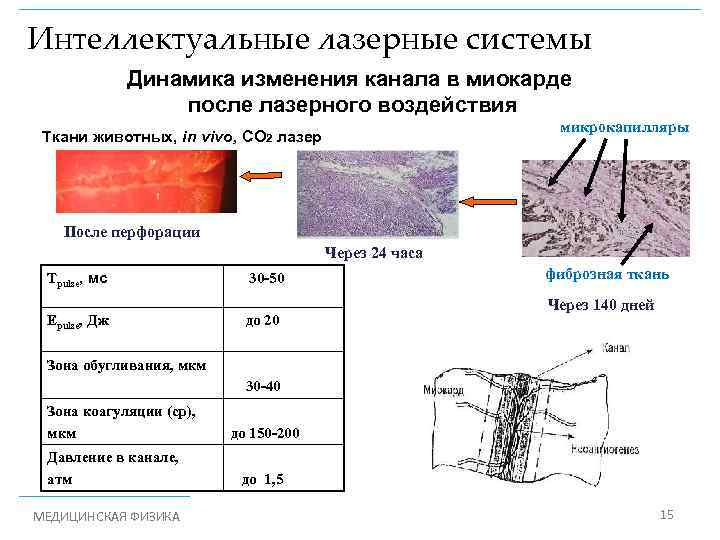 Интеллектуальные лазерные системы Динамика изменения канала в миокарде после лазерного воздействия микрокапилляры Ткани животных,