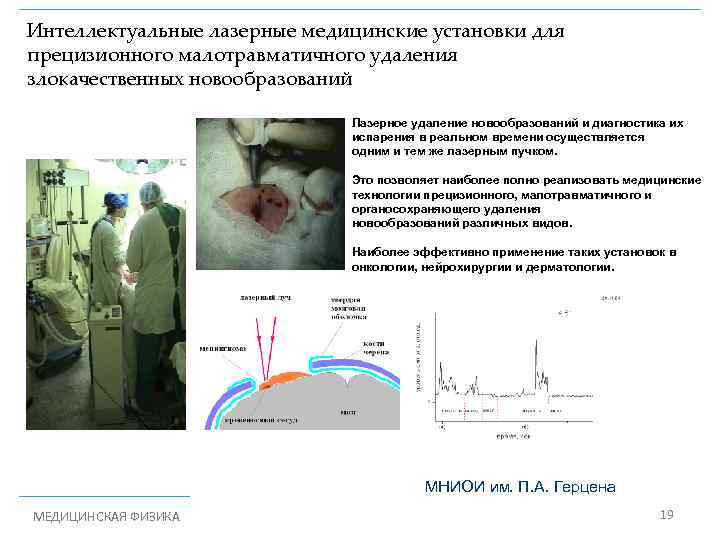 Интеллектуальные лазерные медицинские установки для прецизионного малотравматичного удаления злокачественных новообразований Лазерное удаление новообразований и