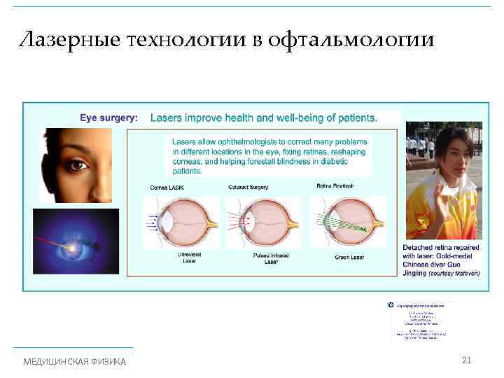 Лазерные технологии в офтальмологии © МЕДИЦИНСКАЯ ФИЗИКА 21 
