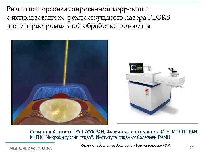Развитие персонализированной коррекции с использованием фемтосекундного лазера FLOKS для интрастромальной обработки роговицы Совместный проект
