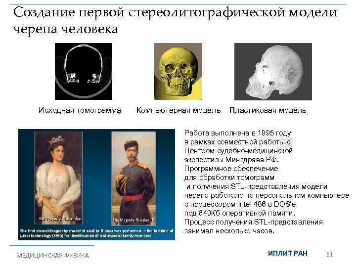 Создание первой стереолитографической модели Лазерная стереолитография черепа человека Исходная томограмма Компьютерная модель Пластиковая модель