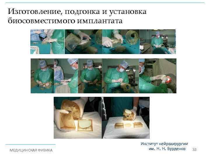 Изготовление, подгонка и установка биосовместимого имплантата МЕДИЦИНСКАЯ ФИЗИКА Институт нейрохирургии им. Н. Н. Бурденко