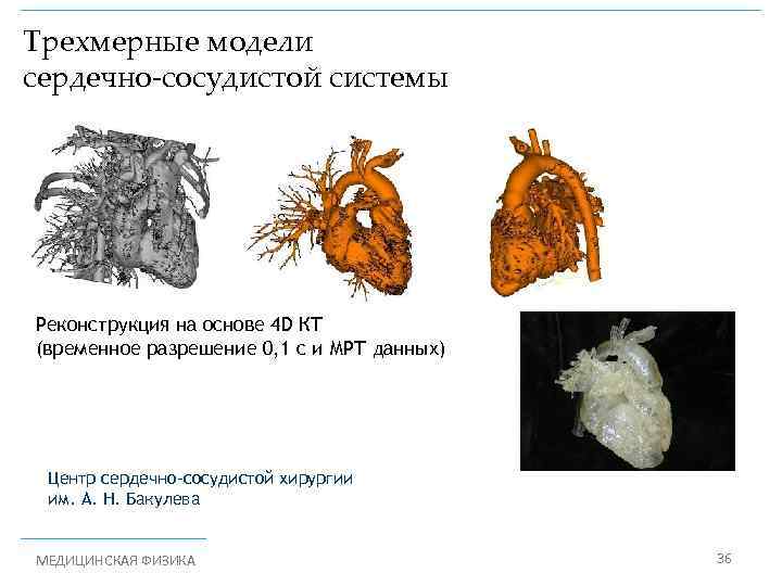 Трехмерные модели сердечно-сосудистой системы Реконструкция на основе 4 D КТ (временное разрешение 0, 1