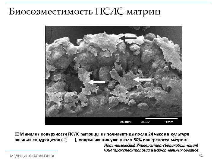 Биосовместимость ПСЛС матриц СЭМ анализ поверхности ПСЛС матрицы из полилактида после 24 часов в