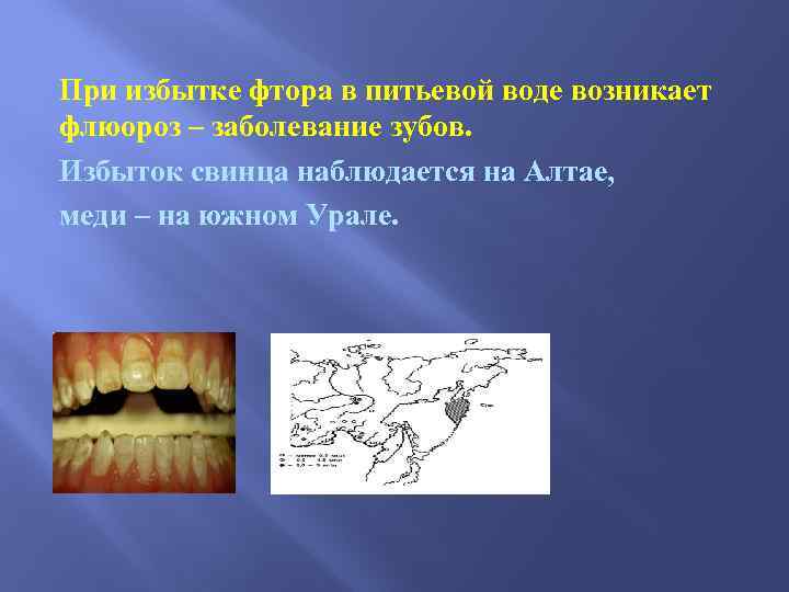 При избытке фтора в питьевой воде возникает флюороз – заболевание зубов. Избыток свинца наблюдается