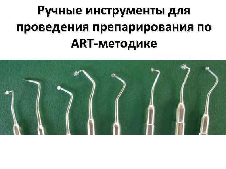 Ручные инструменты для проведения препарирования по ART-методике 