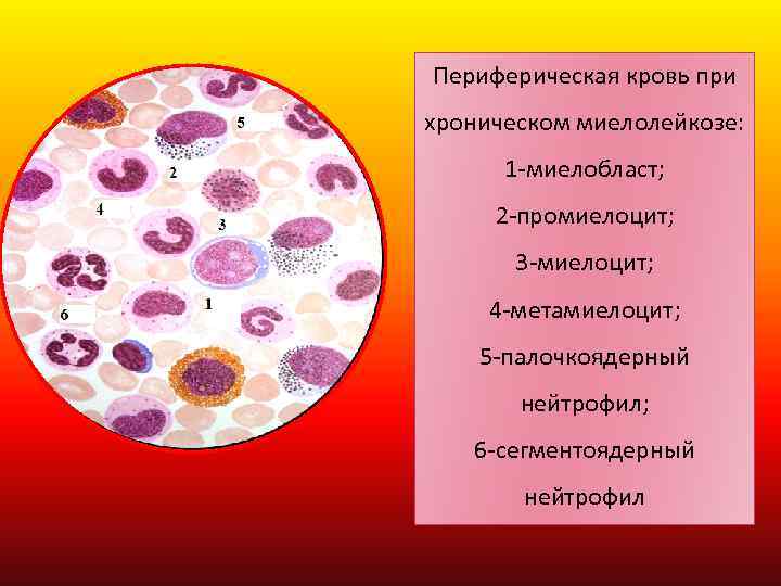 Миелоциты в костном мозге