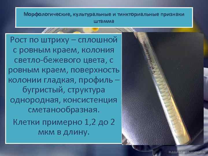 Морфологические, культуральные и тинкториальные признаки штамма Рост по штриху – сплошной с ровным краем,