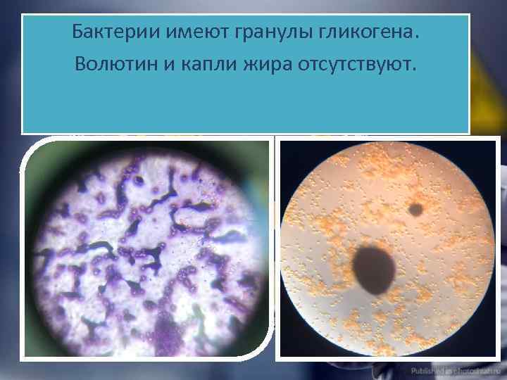 Бактерии имеют гранулы гликогена. Волютин и капли жира отсутствуют. 