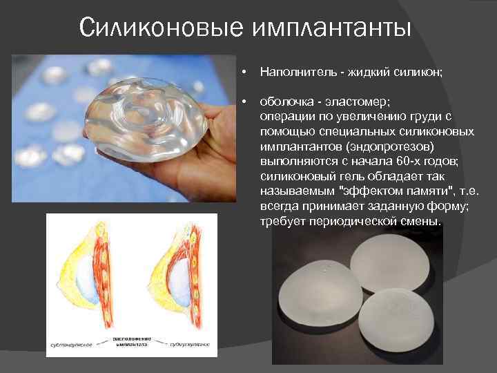 Силиконовые имплантанты • Наполнитель - жидкий силикон; • оболочка - эластомер; операции по увеличению