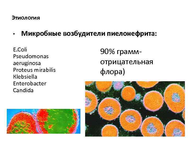 Этиология • Микробные возбудители пиелонефрита: E. Coli Pseudomonas aeruginosa Proteus mirabilis Кlebsiella Enterobacter Candida