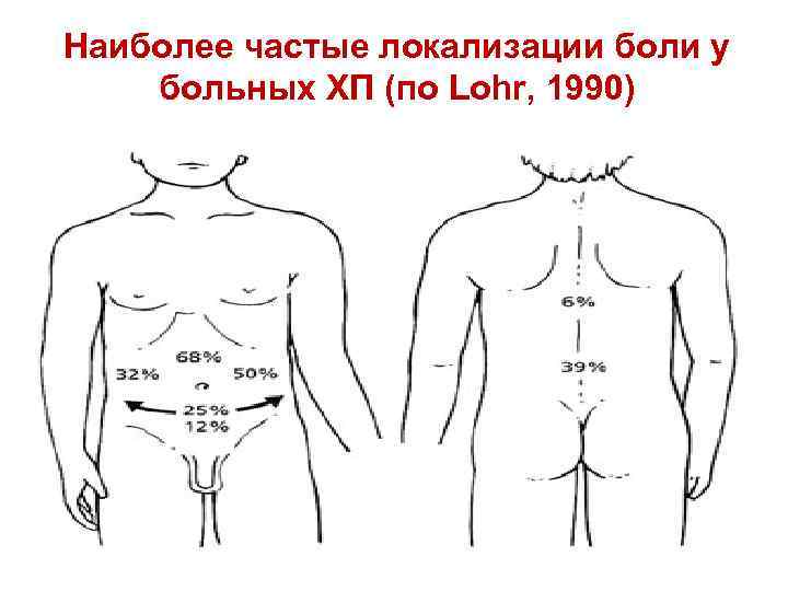 Наиболее частые локализации боли у больных ХП (по Lohr, 1990) 