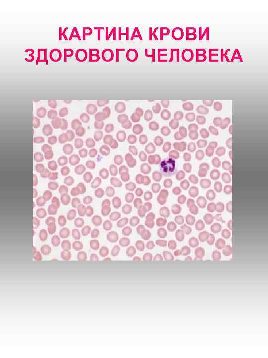 КАРТИНА КРОВИ ЗДОРОВОГО ЧЕЛОВЕКА 