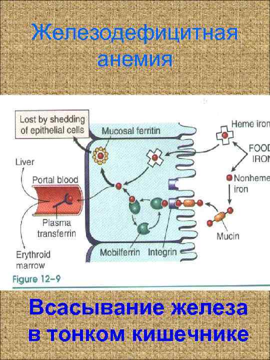 Железодефицитная анемия Всасывание железа в тонком кишечнике 