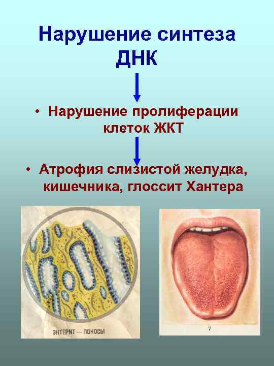 Нарушение синтеза ДНК • Нарушение пролиферации клеток ЖКТ • Атрофия слизистой желудка, кишечника, глоссит