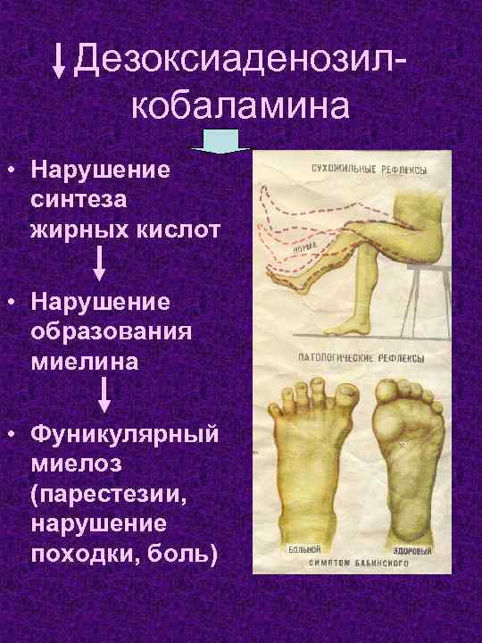 Дезоксиаденозилкобаламина • Нарушение синтеза жирных кислот • Нарушение образования миелина • Фуникулярный миелоз (парестезии,