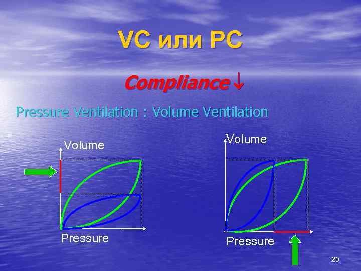 VC или РС Compliance Pressure Ventilation : Volume Ventilation Volume Pressure 20 