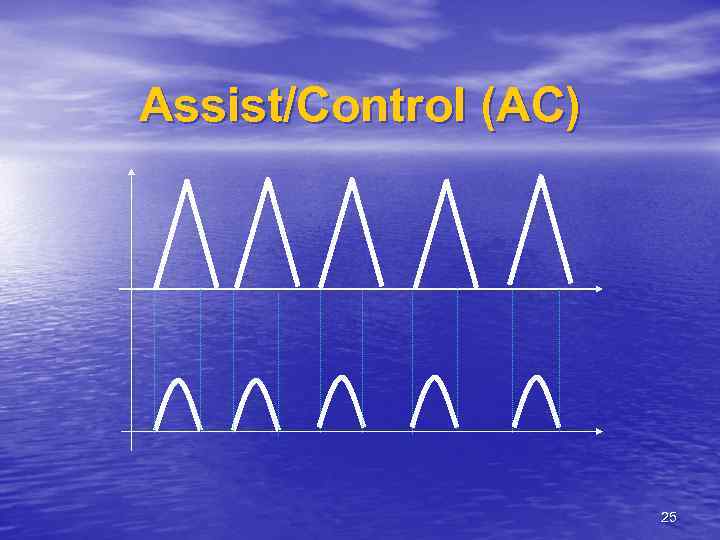 Assist/Control (AC) 25 