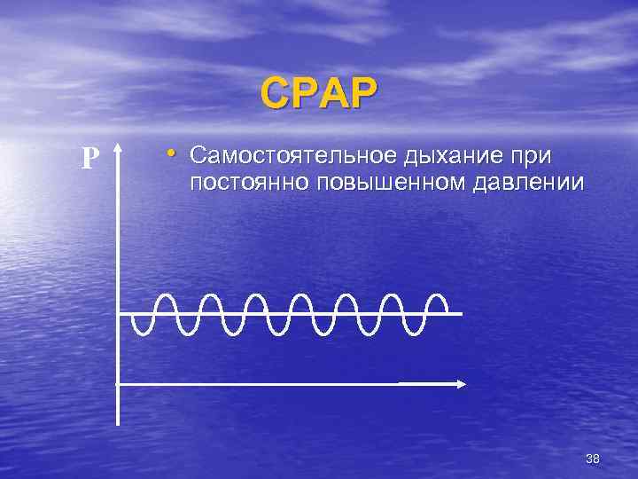 CPAP P • Самостоятельное дыхание при постоянно повышенном давлении 38 