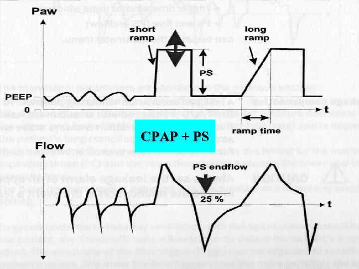 CPAP + PS 39 