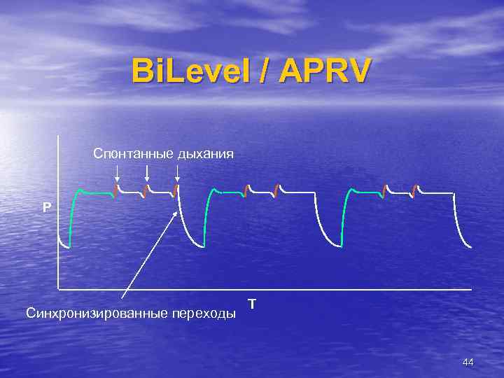 Bi. Level / APRV Спонтанные дыхания P Синхронизированные переходы T 44 